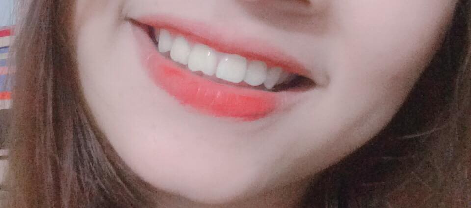 Khoe môi gợi cảm tiện thể khoe luôn ria mép, cô gái khiến cư dân mạng mắt xem ảnh tay nhặt mồm vì cười Khoe môi gợi cảm tiện thể khoe luôn ria mép, cô gái khiến cư dân mạng mắt xem ảnh tay nhặt mồm vì cười